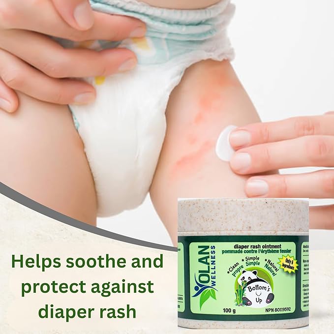 Bottoms Up Diaper Rash Ointment by Olan Wellness – Thick Zinc Oxide Barrier Cream, Melts on Contact, Helps Soothe & Protect Sensitive Skin, Baby Balm for Newborns & Toddlers