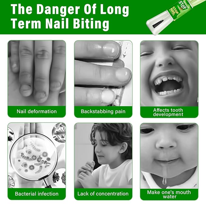 Nail Biting Treatment for Kids, Natural Nail Biting Prevention for Kids, Toddlers, Children, Help Break Nail-Chewing & Thumb-Sucking Habits