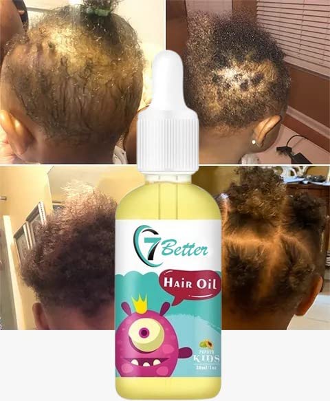 Natural Baby Kids Hair Care Products - Extra Strength Growing & Nourishing Serum with Black Seed Oil for Powerful, Thick, and Full Hair Growth