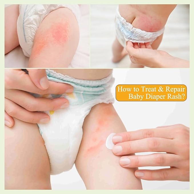PEGO Baby Diaper Rash Cream,with Zinc Oxide,Egg Yolk Oil - Prevents, Soothes Diaper Rash,Gentle Non-Irritating for Toddlers' Sensitive Skin,(100ml, 3.38, Fl Oz)