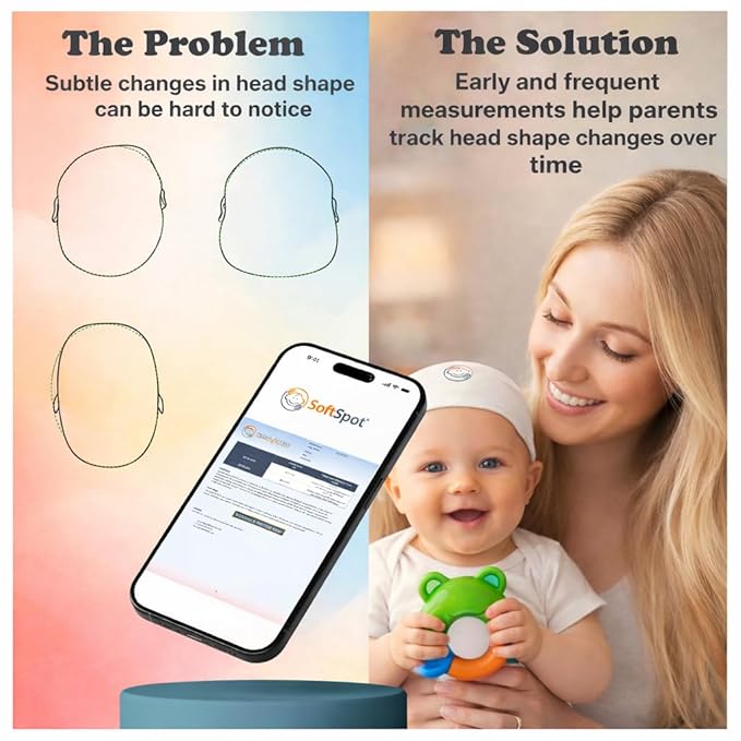 SoftSpot Baby Head Shape Measurement Kit – Measure & Track Baby Head Shape at Home with SoftSpot App (iOS & Android) – Includes Cap & Unlimited App Measurements