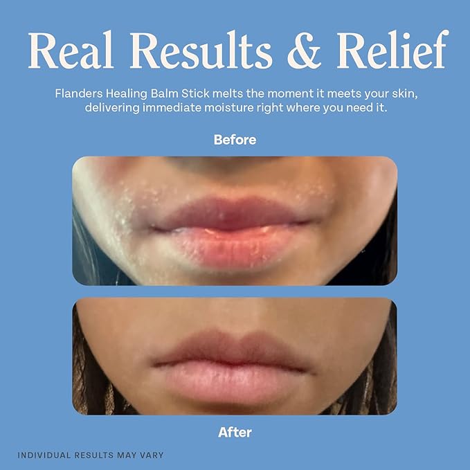 Flanders Healing Balm Stick 0.5oz | Natural Moisturizing Balm for Sensitive Skin, Windburn Protection, Chapped Lip & Dry Skin Relief for All Ages, Lanolin & Fragrance Free, TSA Compliant Size