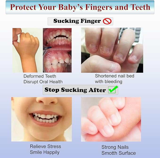 Thumb Sucking Guard Stop 5 Fingers Sucking Gloves for Baby Nail Biting Prevention Breathable Thumb Sucking Stopper Anti Finger Chewing Gloves for Kids (XL)