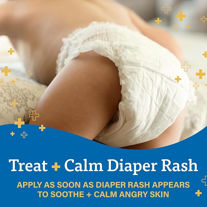 A+D Diaper Rash Cream, Zinc Oxide Cream, 4 oz (113 g) by A&D