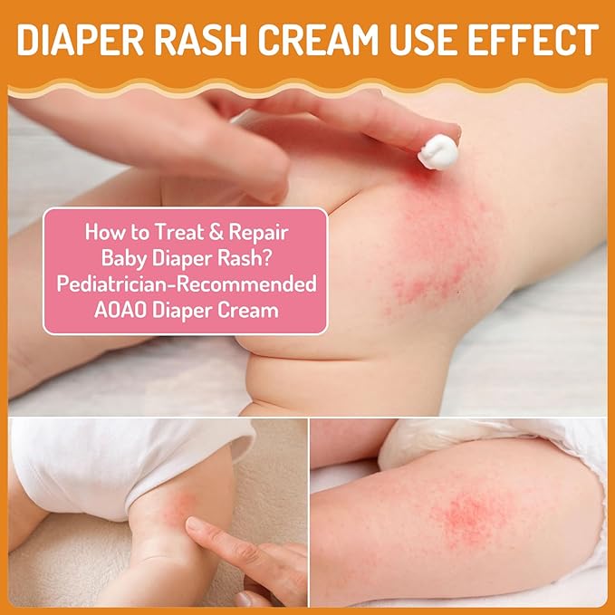 Baby Diaper Rash Cream, for Prevent, Soothe and Treat Breakouts Diaper Rash and Flare-Ups, Instant Soothing Baby Skin Discomfort, Fast Relief for Diaper Rash, Gentle Nappy Rash Ointment, 100ml/3.38oz