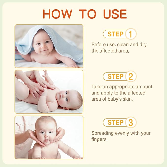 AOAO Baby Eczema Cream - Kids Eczema Therapy & Relief Body Cream, Nourishing Skin Protectant Soothes & Relieves Dry, Hypoallergenic, Fragrance & Steroid-Free (100ml, Fl Oz, 3.38) (White+)
