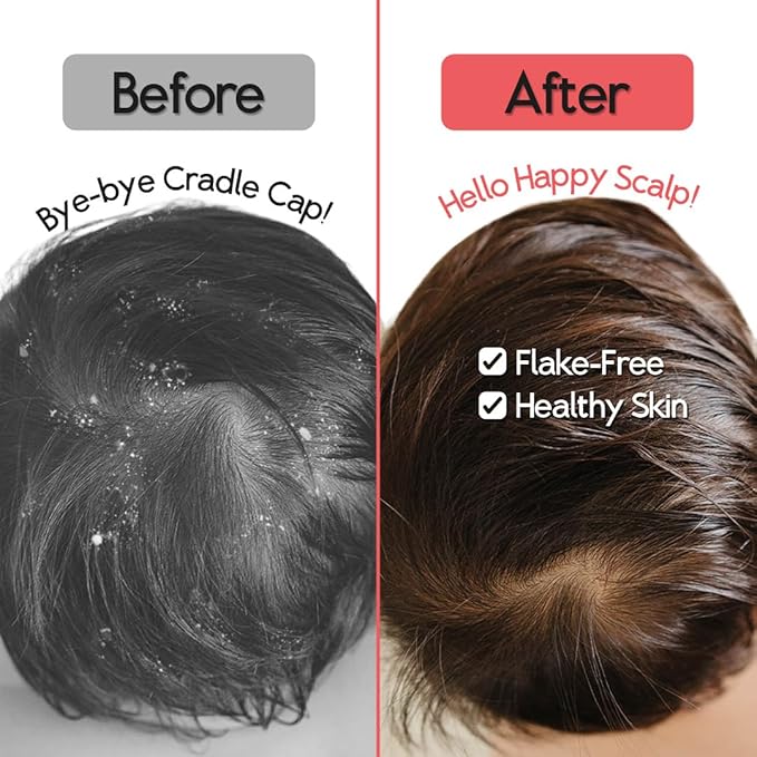 SplashEZ Cradle Cap Brush for Babies | Soothing Newborn Head Massager | Food-Grade Soft Silicone Baby Bath Brush & Scalp Scrubber | Infant Cradle Cap Comb - Organic Shape & Ladybug Design, 2-Pack