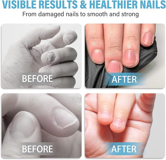 Nail Biting Treatment for Kids, Nail Biting Prevention for Kids and Thumb Sucking Deterrent Cream to Stop Sucking Thumb, Natural Plant Bitter Formula, 60ML