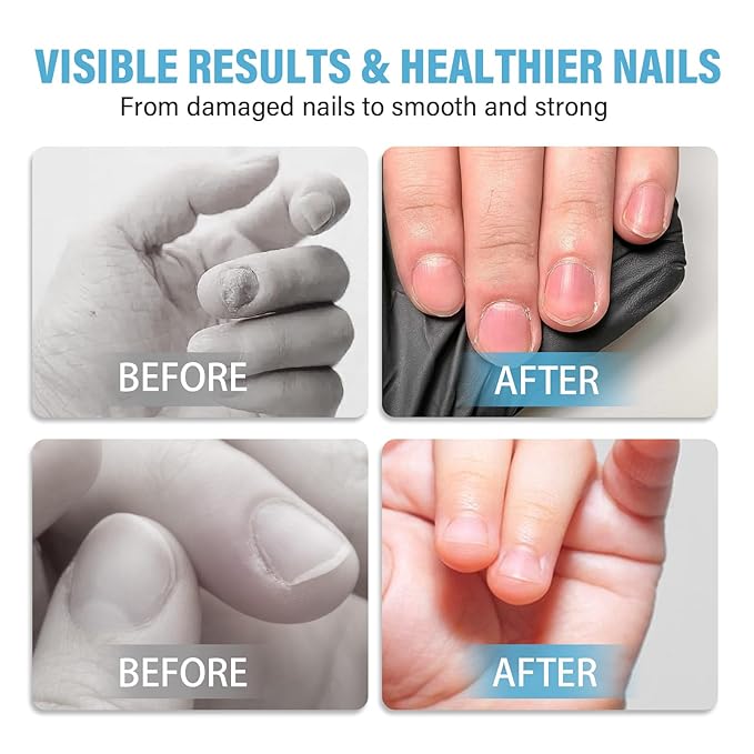 Nail Biting Treatment for Kids,Thumb Sucking Deterrent Cream, Nail Biting Prevention for Kids, Toddlers, Children Help Stop Sucking Thumb, Natural Plant Bitter Formula for Gentle Care, 60ML
