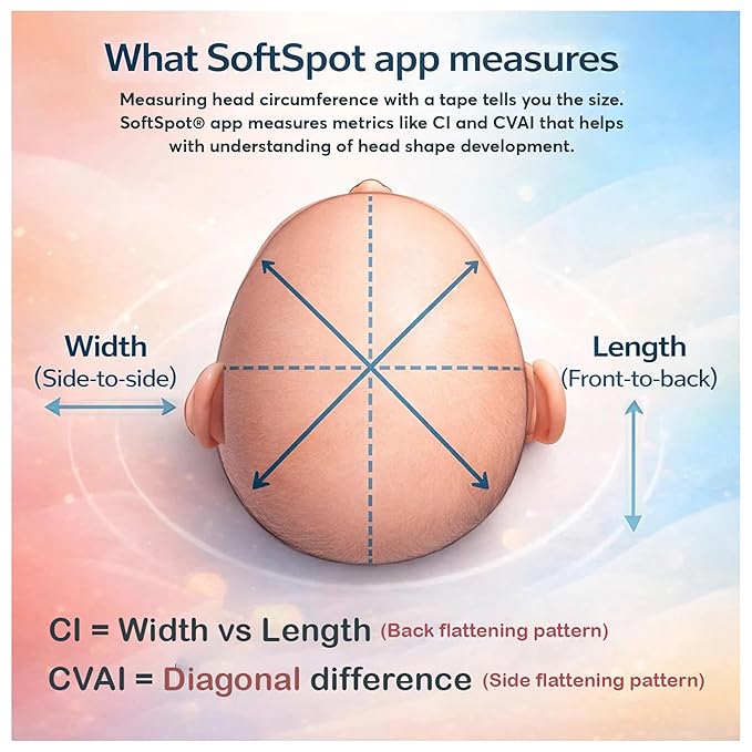 SoftSpot Baby Head Shape Measurement Kit – Measure & Track Baby Head Shape at Home with SoftSpot App (iOS & Android) – Includes Cap & Unlimited App Measurements