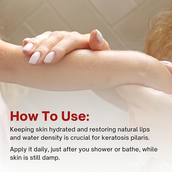 Moisturizing Keratosis Pilaris Cream for Kids | Gentle Hydration for Dry, Bumpy Skin | Dermatologist-Developed Lotion | Non-Irritating, Acid-Free Formula | 16 oz