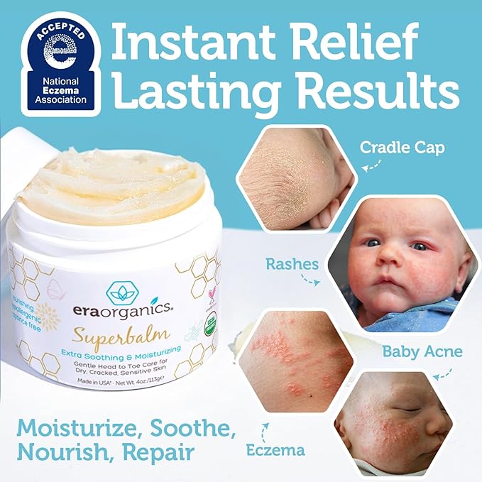 Era Organics Healing Ointment for Babies - USDA Certified Organic Natural Moisturizer Gentle on Sensitive Skin Prone To Baby Eczema, Cradle Cap (Infant Seborrheic Dermatitis), Rashes, Hives - 4oz