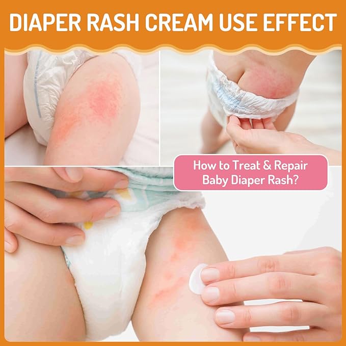 Baby Diaper Rash Cream, for Prevent, Soothe and Treat Breakouts Diaper Rash and Flare-Ups, Instant Soothing Baby Skin Discomfort, Fast Relief for Diaper Rash, Gentle Nappy Rash Ointment, 100ml/3.38oz