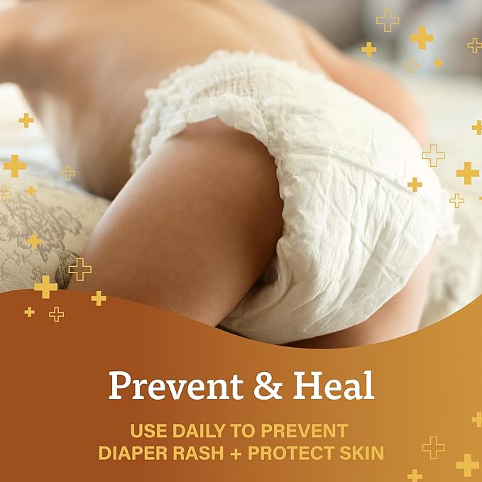 A+D Original Diaper Ointment + Cream 4 oz. Variety Pack - Prevents & Treats Rash, Moisturizing Skin Protectant with Vitamins A & D