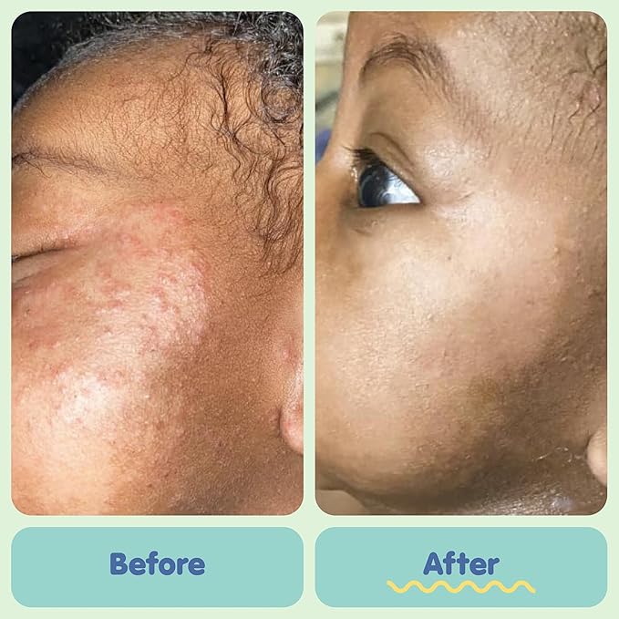 TUBBY TODD Baby Bath & Skincare Kit - The Baby Bundle - Shampoo and Body Wash, Everyday Lotion 8.5 Oz, All Over Ointment 3.5 Oz & Diaper Paste Cream 7.9 Oz Gift Set - Lavender Rosemary