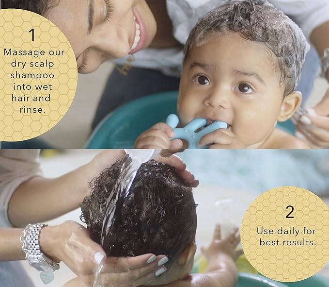 BELLA B GIFT SET Organic Cradle Cap Shampoo & Conditioner Treatment for Babies 8oz, Natural Ingredient Baby Shampoo with Complete Care Set for Baby Cradle Cap | Baby Hair Conditioner for Toddler