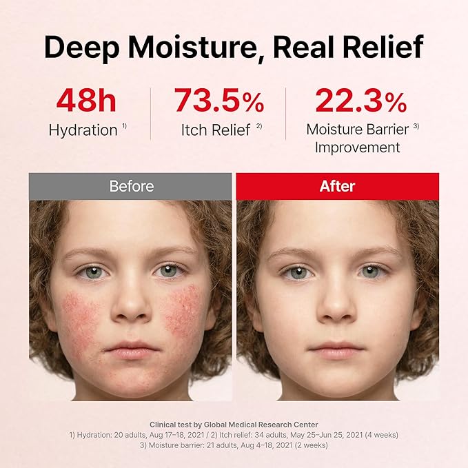 ATOPALM Intensive Moisturizing Cream | Premium Baby Lotion | Baby Face and Body Moisturizer for Skin Barrier | Replenishes Hydration, Paraben-Free | For Kids Age 6+, 3.4 Fl Oz, 100ml